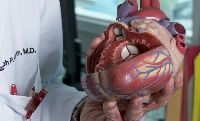 Heart valve replacement model