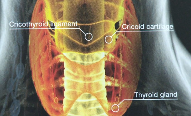 Graves’ disease symptoms and treatment diagram of immune system 