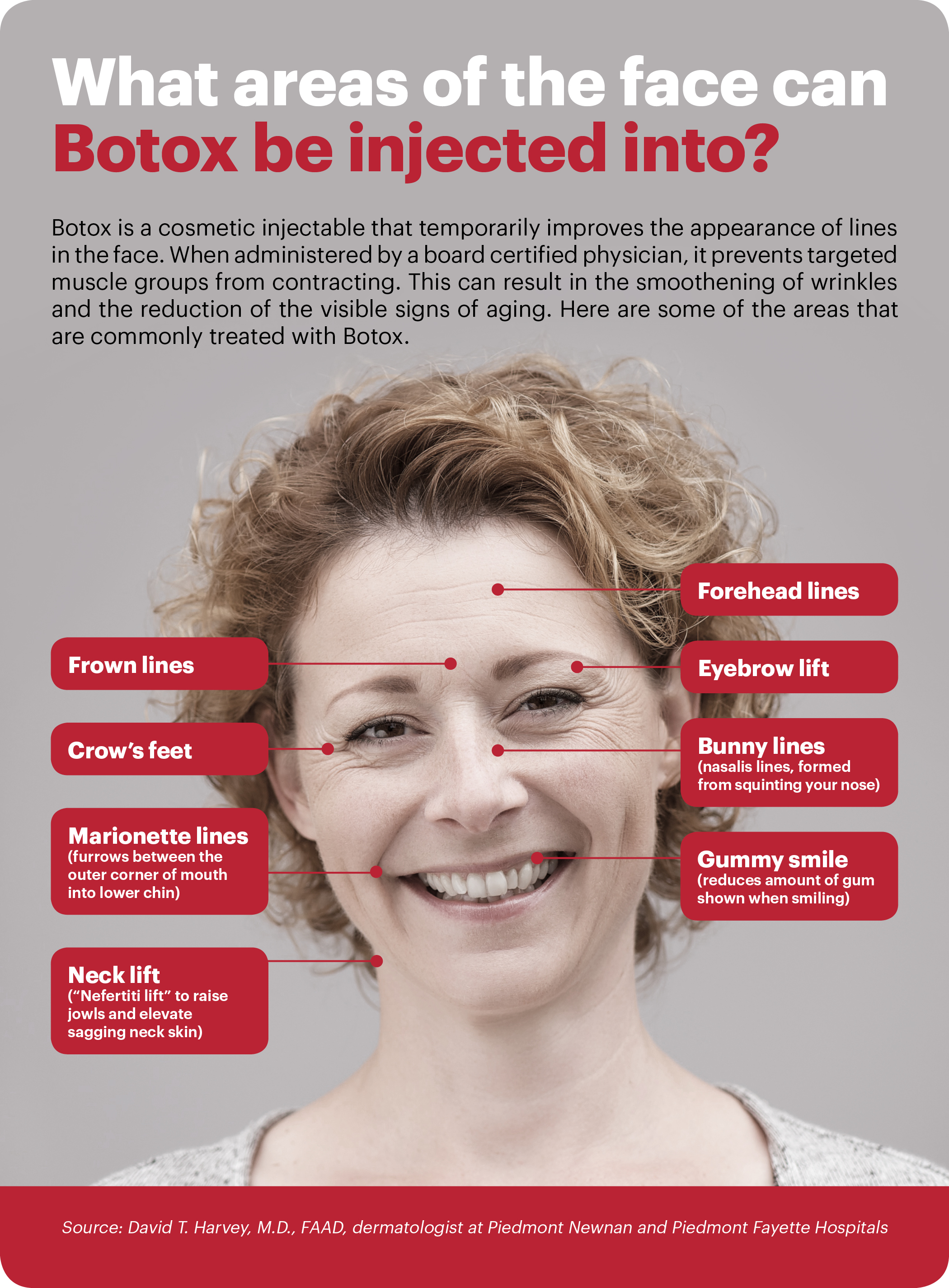 Graphic on cosmetic botox.