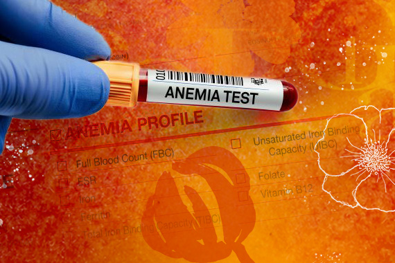 photo of an anemia blood test and paperwork