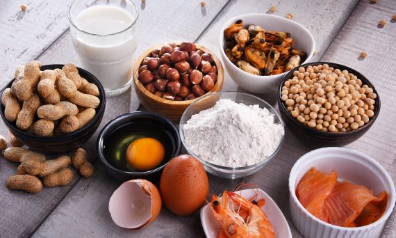 photo of the most common food allergy triggers: nuts, eggs, fish, shellfish, legumes and wheat
