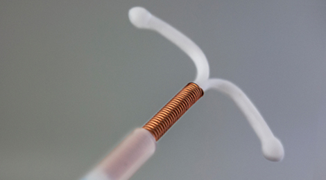 Long-acting reversible contraceptives 