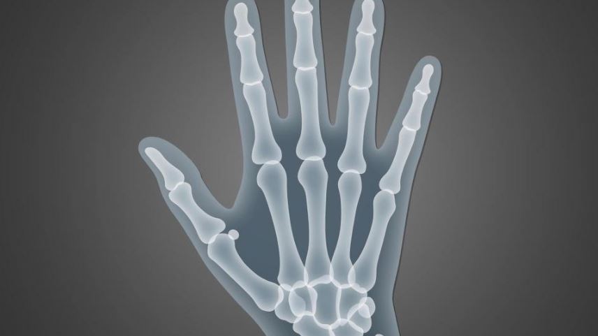 Hand x-ray