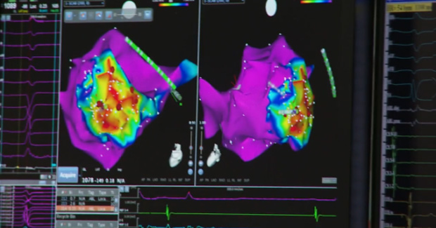 Piedmont Heart Institute's Electrophysiology Program Screenshot