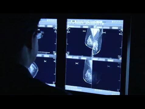 3D mammogram technology