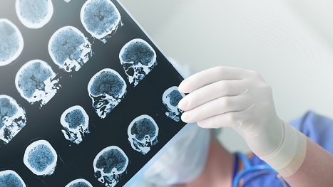 Brain surgeon studying x-rays.