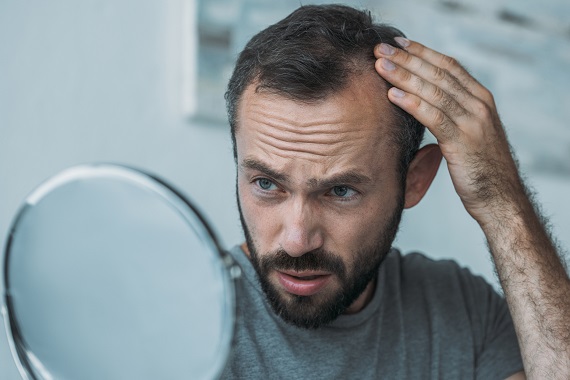 man looking in the mirror at his hairline