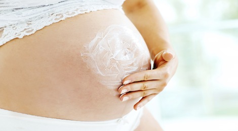 Pregnancy stretch marks