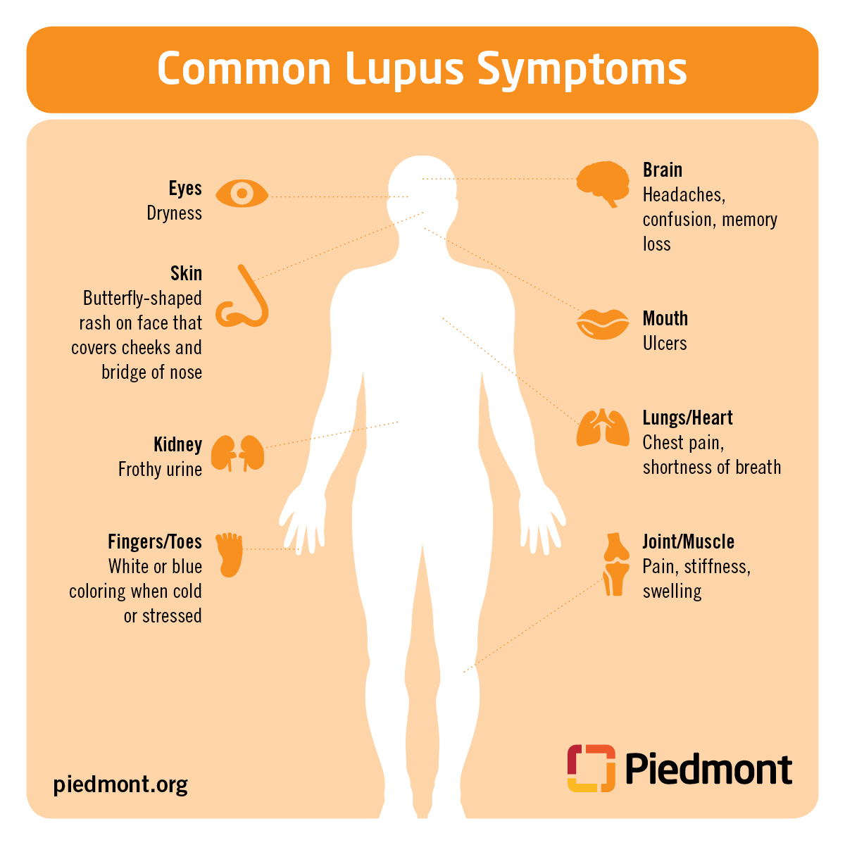 what happens with a lupus flare up