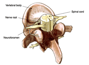 Transforaminal Lumber Interbody Fusion 