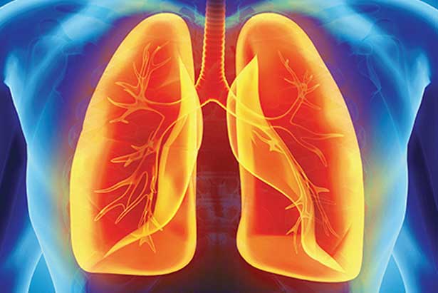 Global Pulmonary Fibrosis Awareness Month