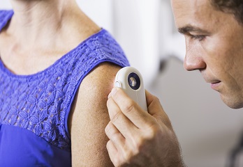 Skin Cancer