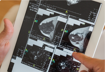 woman prepping for a mammogram