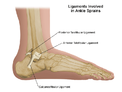 Soft-Tissue Injuries