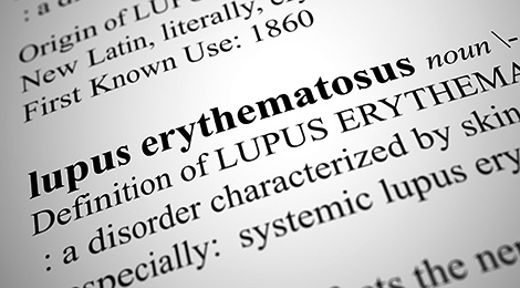 Lupus defined online.